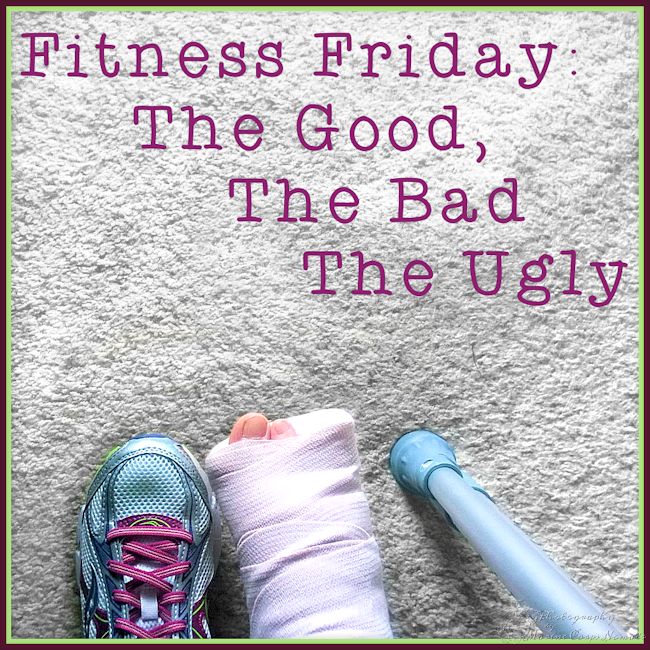 Fitness Friday - when injury interrupts your regularly scheduled fitness routine